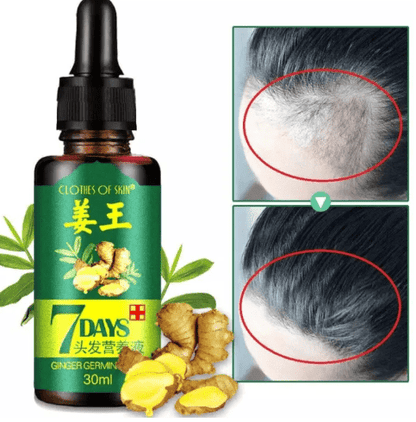 7 Days Hair Growth Serum with 540 Micro-Needle Derma Roller
